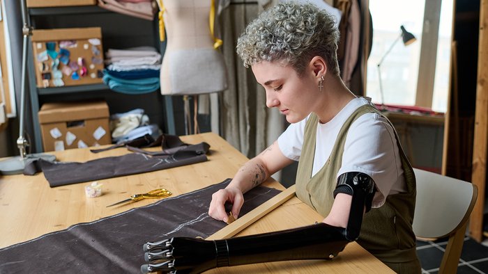 junge Frau mit Armprothese 